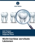 Cover: Nicht-karioese zervikale Laesionen - Verlag Unser Wissen