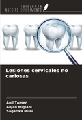 Cover: Lesiones cervicales no cariosas - Ediciones Nuestro Conocimiento