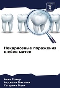 Cover: Nekarioznye porazheniq shejki matki - Sciencia Scripts