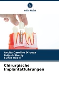 Cover: Chirurgische Implantatfuehrungen - Verlag Unser Wissen