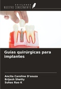 Cover: Gu&iacute;as quir&uacute;rgicas para implantes - Ediciones Nuestro Conocimiento