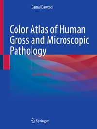Abbildung von: Color Atlas of Human Gross and Microscopic Pathology - Springer