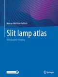 Bild: Slit lamp atlas - Springer