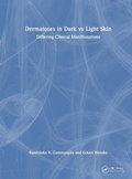 Cover: Dermatoses in Dark Vs Light Skin - CRC Press