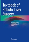 Bild: Textbook of Robotic Liver Surgery - Springer