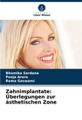 Cover: Zahnimplantate - Verlag Unser Wissen