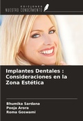 Cover: Implantes Dentales : Consideraciones en la Zona Est&eacute;tica - Ediciones Nuestro Conocimiento