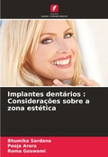 Cover: Implantes dentarios - Edicoes Nosso Conhecimento