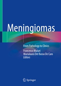 Abbildung von: Meningiomas - Springer