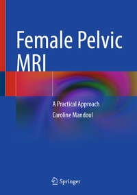 Abbildung von: Female Pelvic MRI - Springer