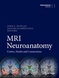 Abbildung von: MRI Neuroanatomy - Springer