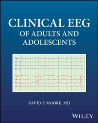 Abbildung von: Clinical EEG of Adults and Adolescents - Wiley