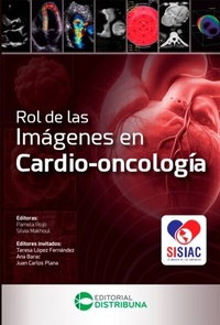 Abbildung von: Rol de las imágenes en cardio-oncología - Distribuna Editorial Médica