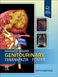 Abbildung von: Diagnostic Imaging: Genitourinary - Churchill Livingstone