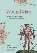 Cover: Wound Man - Princeton University Press