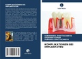 Cover: Komplikationen Bei Implantaten - Verlag Unser Wissen