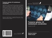 Abbildung von: Tumores gliales VS metástasis cerebrales - Ediciones Nuestro Conocimiento