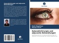 Cover: Kataraktchirurgie und adjuvante Behandlungen - Verlag Unser Wissen