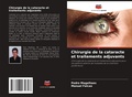 Cover: Chirurgie de la cataracte et traitements adjuvants - Editions Notre Savoir