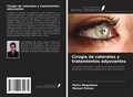 Cover: Cirug&iacute;a de cataratas y tratamientos adyuvantes - Ediciones Nuestro Conocimiento