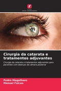 Cover: Cirurgia da catarata e tratamentos adjuvantes - Edicoes Nosso Conhecimento