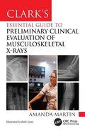 Cover: Clark's Essential Guide to Preliminary Clinical Evaluation of Musculoskeletal X-rays - CRC Press