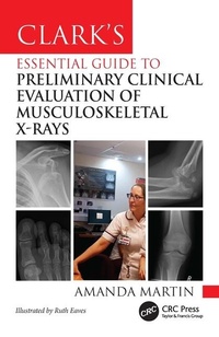 Enlarge image Cover: Clark's Essential Guide to Preliminary Clinical Evaluation of Musculoskeletal X-rays - CRC Press