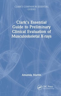 Enlarge image Cover: Clark's Essential Guide to Preliminary Clinical Evaluation of Musculoskeletal X-rays - CRC Press
