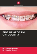Cover: Fios de Arco Em Ortodontia - Edicoes Nosso Conhecimento