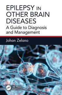Abbildung von: Epilepsy in Other Brain Diseases - CRC Press