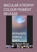 Cover: Macular Atrophy Colour Pigment Release, Photographic Evidence Book 4 (Macular Degeneration Atrophy, Photographic Evidence Series of   Books, #15) - Agnes Musa