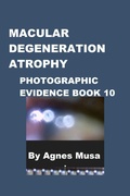 Cover: Macular Degeneration Atrophy, Photographic Evidence Book 10 (Macular Degeneration Atrophy, Photographic Evidence Series of   Books, #2) - Agnes Musa