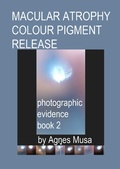 Cover: Macular Atrophy Colour Pigment Release, Photographic Evidence Book 2 (Macular Degeneration Atrophy, Photographic Evidence Series of   Books, #13) - Agnes Musa