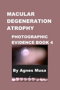 Cover: Macular Degeneration Atrophy, Photographic Evidence Book 4 (Macular Degeneration Atrophy, Photographic Evidence Series of   Books, #6) - Agnes Musa