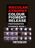 Cover: Macular Atrophy Colour Pigment Release, Photographic Evidence Book 1 (Macular Degeneration Atrophy, Photographic Evidence Series of   Books, #12) - Agnes Musa