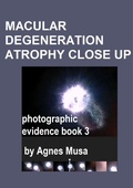 Cover: Macular Degeneration Atrophy Close Up, Photographic Evidence Book 3 (Macular Degeneration Atrophy, Photographic Evidence Series of   Books, #19) - Agnes Musa
