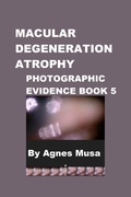 Cover: Macular Degeneration Atrophy, Photographic Evidence Book 5 (Macular Degeneration Atrophy, Photographic Evidence Series of   Books, #7) - Agnes Musa