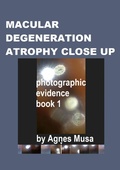Cover: Macular Degeneration Atrophy Close Up, Photographic Evidence Book 1 (Macular Degeneration Atrophy, Photographic Evidence Series of   Books, #17) - Agnes Musa