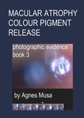 Cover: Macular Atrophy Colour Pigment Release, Photographic Evidence Book 3 (Macular Degeneration Atrophy, Photographic Evidence Series of   Books, #14) - Agnes Musa