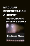 Cover: Macular Degeneration Atrophy, Photographic Evidence Book 6 (Macular Degeneration Atrophy, Photographic Evidence Series of   Books, #8) - Agnes Musa