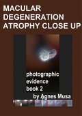 Cover: Macular Degeneration Atrophy Close Up, Photographic Evidence Book 2 (Macular Degeneration Atrophy, Photographic Evidence Series of   Books, #18) - Agnes Musa