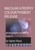 Cover: Macular Atrophy Colour Pigment Release, Photographic Evidence Book 5 (Macular Degeneration Atrophy, Photographic Evidence Series of   Books, #16) - Agnes Musa