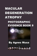 Cover: Macular Degeneration, Photographic Evidence Book 8 (Macular Degeneration Atrophy, Photographic Evidence Series of   Books, #11) - Agnes Musa