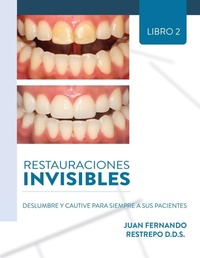 Abbildung von: Restauraciones Invisibles - Ibukku, LLC