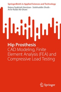 Abbildung von: Hip Prosthesis - Springer