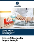 Cover: Misserfolge in der Implantologie - Verlag Unser Wissen