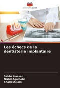 Cover: Les echecs de la dentisterie implantaire - Editions Notre Savoir