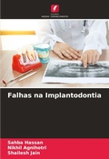 Cover: Falhas na Implantodontia - Edicoes Nosso Conhecimento