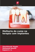 Cover: Melhoria do cume na terapia com implantes - Edicoes Nosso Conhecimento