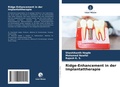 Cover: Ridge-Enhancement in der Implantattherapie - Verlag Unser Wissen